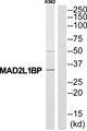CMT2 / MAD2L1BP Antibody - Western blot analysis of extracts from K562 cells, using MAD2L1BP antibody.