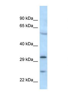 CMT2 / MAD2L1BP Antibody - MAD2L1BP antibody Western blot of 435S Cell lysate. Antibody concentration 1 ug/ml.  This image was taken for the unconjugated form of this product. Other forms have not been tested.
