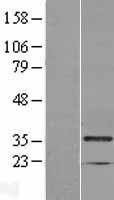 CMT2 / MAD2L1BP Protein - Western validation with an anti-DDK antibody * L: Control HEK293 lysate R: Over-expression lysate