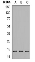 CMTM1 Antibody - Western blot analysis of CMTM1 expression in HEK293T (A); Raw264.7 (B); H9C2 (C) whole cell lysates.