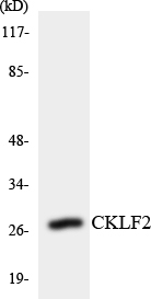 CMTM2 Antibody - Western blot analysis of the lysates from COLO205 cells using CKLF2 antibody.
