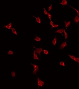 CMTM2 Antibody - Staining HeLa cells by IF/ICC. The samples were fixed with PFA and permeabilized in 0.1% Triton X-100, then blocked in 10% serum for 45 min at 25°C. The primary antibody was diluted at 1:200 and incubated with the sample for 1 hour at 37°C. An Alexa Fluor 594 conjugated goat anti-rabbit IgG (H+L) Ab, diluted at 1/600, was used as the secondary antibody.