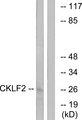 CMTM2 Antibody - Western blot analysis of extracts from K562 cells, using CKLF2 antibody.