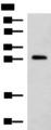 CMTM2 Antibody - Western blot analysis of K562 cell lysate  using CMTM2 Polyclonal Antibody at dilution of 1:1000