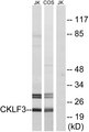 CMTM3 Antibody - Western blot analysis of lysates from Jurkat and COS cells, using CKLF3 Antibody. The lane on the right is blocked with the synthesized peptide.