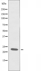 CMTM3 Antibody - Western blot analysis of extracts of Jurkat cells using CKLF3 antibody.