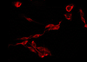 CMTM3 Antibody - Staining HeLa cells by IF/ICC. The samples were fixed with PFA and permeabilized in 0.1% Triton X-100, then blocked in 10% serum for 45 min at 25°C. The primary antibody was diluted at 1:200 and incubated with the sample for 1 hour at 37°C. An Alexa Fluor 594 conjugated goat anti-rabbit IgG (H+L) Ab, diluted at 1/600, was used as the secondary antibody.