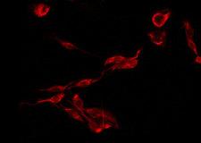 CMTM3 Antibody - Staining HeLa cells by IF/ICC. The samples were fixed with PFA and permeabilized in 0.1% Triton X-100, then blocked in 10% serum for 45 min at 25°C. The primary antibody was diluted at 1:200 and incubated with the sample for 1 hour at 37°C. An Alexa Fluor 594 conjugated goat anti-rabbit IgG (H+L) Ab, diluted at 1/600, was used as the secondary antibody.