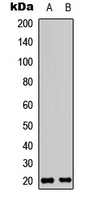 CMTM3 Antibody - Western blot analysis of CMTM3 expression in Raji (A); K562 (B) whole cell lysates.