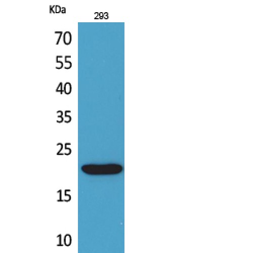 CMTM6 / CKLFSF6 Antibody - Western blot of CMTM6 antibody