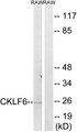 CMTM6 / CKLFSF6 Antibody - Western blot analysis of lysates from RAW264.7 cells, using CKLF6 Antibody. The lane on the right is blocked with the synthesized peptide.