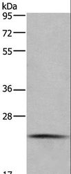 CMTM6 / CKLFSF6 Antibody - Western blot analysis of Raji cell, using CMTM6 Polyclonal Antibody at dilution of 1:200.