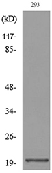 CMTM6 / CKLFSF6 Antibody - Western blot analysis of lysate from 293 cells, using CMTM6 Antibody.