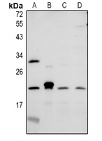 CMTM6 / CKLFSF6 Antibody - Western blot analysis of CMTM6 expression in rat testis (A), CT26 (B), A549 (C), LO2 (D) whole cell lysates.