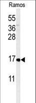 CMTM7 / CKLFSF7 Antibody - Western blot of CMTM7 Antibody in Ramos cell line lysates (35 ug/lane). CMTM7 (arrow) was detected using the purified antibody.