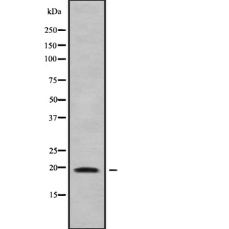 CMTM7 / CKLFSF7 Antibody - Western blot analysis of CKLF7 using K562 whole cells lysates