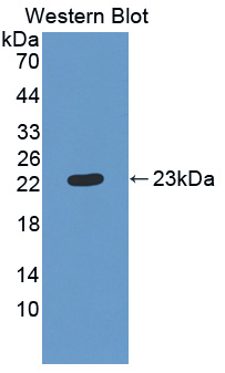 CMTM8 Antibody - Western blot of CMTM8 antibody.