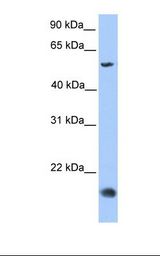 CMTM8 Antibody - HepG2 cell lysate. Antibody concentration: 1.0 ug/ml. Gel concentration: 12%.  This image was taken for the unconjugated form of this product. Other forms have not been tested.