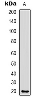 CMTM8 Antibody - Western blot analysis of CMTM8 expression in HeLa (A) whole cell lysates.