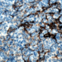 CMTM8 Antibody - Immunohistochemical analysis of CMTM8 staining in human tonsil formalin fixed paraffin embedded tissue section. The section was pre-treated using heat mediated antigen retrieval with sodium citrate buffer (pH 6.0). The section was then incubated with the antibody at room temperature and detected using an HRP polymer system. DAB was used as the chromogen. The section was then counterstained with hematoxylin and mounted with DPX.