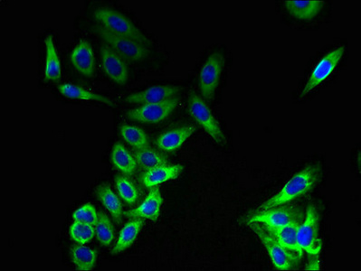 CMTM8 Antibody - Immunofluorescent analysis of HepG2 cells using CMTM8 Antibody at dilution of 1:100 and Alexa Fluor 488-congugated AffiniPure Goat Anti-Rabbit IgG(H+L)