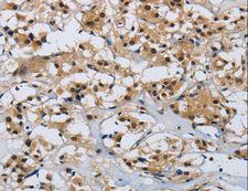 CMTM8 Antibody - Immunohistochemistry of paraffin-embedded Human brain using CMTM8 Polyclonal Antibody at dilution of 1:40.