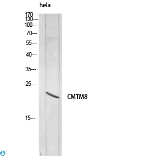 CMTM8 Antibody - Immunohistochemistry (IHC) analysis of paraffin-embedded Human Tonsils2, antibody was diluted at 1:100.