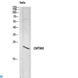 CMTM8 Antibody - Immunohistochemistry (IHC) analysis of paraffin-embedded Human Tonsils2, antibody was diluted at 1:100.