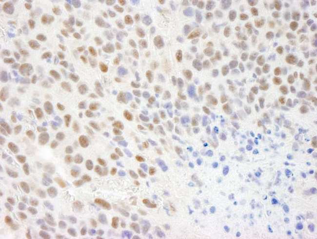 CMTR1 / FTSJD2 Antibody - Detection of Mouse KIAA0082 by Immunohistochemistry. Sample: FFPE section of mouse colon carcinoma. Antibody: Affinity purified rabbit anti-KIAA0082 used at a dilution of 1:250.