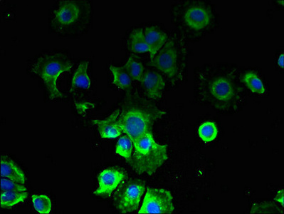 CMTR2 / FTSJD1 Antibody - Immunofluorescent analysis of MCF-7 cells using CMTR2 Antibody at dilution of 1:100 and Alexa Fluor 488-congugated AffiniPure Goat Anti-Rabbit IgG(H+L)
