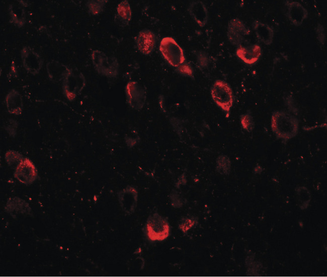 CMYA5 Antibody - Immunofluorescence of SPRYD2 in mouse brain tissue with SPRYD2 antibody at 20 ug/ml.