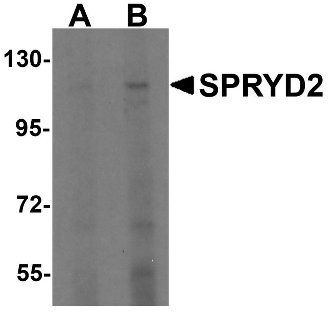 CMYA5 Antibody - Western blot analysis of SPRYD2 in rat brain tissue lysate with SPRYD2 antibody at (A) 2 and (B) 4 ug/ml.