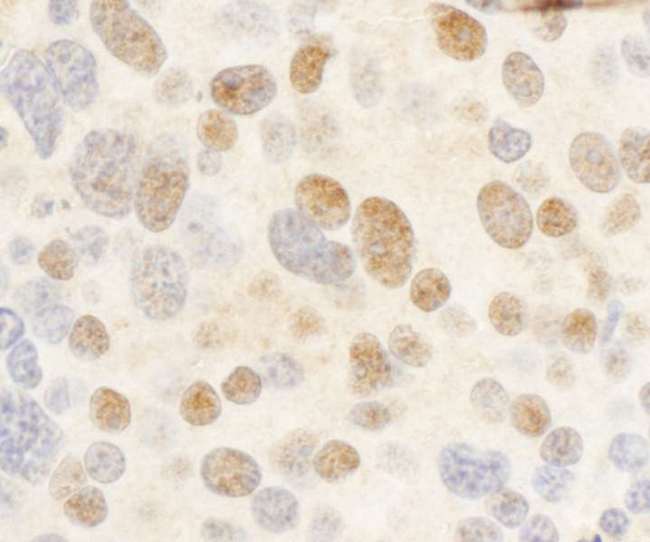 cmyb Antibody - Detection of Mouse c-Myb by Immunohistochemistry. Sample: FFPE section of mouse renal cell carcinoma. Antibody: Affinity purified rabbit anti-c-Myb antibody used at a dilution of 1:1000 (1 ug/ml). Detection: DAB.
