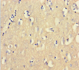 CNBP / ZNF9 Antibody - Immunohistochemistry of paraffin-embedded human brain tissue using CNBP Antibody at dilution of 1:100