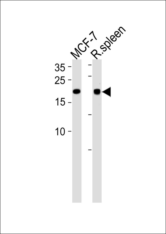 CNBP / ZNF9 Antibody - CNBP Antibody western blot of MCF-7 cell line and rat spleen tissue lysates (35 ug/lane). The CNBP antibody detected the CNBP protein (arrow).