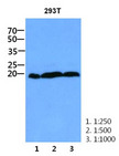 CNBP / ZNF9 Antibody - Western Blot: The cell lysate of 293T (30 ug) were resolved by SDS-PAGE, transferred to PVDF membrane and probed with anti-human CNBP antibody (1:250 - 1:1000). Proteins were visualized using a goat anti-mouse secondary antibody conjugated to HRP and an ECL detection system.