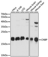 CNBP / ZNF9 Antibody - Western blot analysis of extracts of various cell lines, using CNBP antibody at 1:1000 dilution. The secondary antibody used was an HRP Goat Anti-Rabbit IgG (H+L) at 1:10000 dilution. Lysates were loaded 25ug per lane and 3% nonfat dry milk in TBST was used for blocking. An ECL Kit was used for detection and the exposure time was 5s.