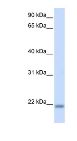 CNBP / ZNF9 Antibody - CNBP antibody Western blot of Fetal Brain lysate. This image was taken for the unconjugated form of this product. Other forms have not been tested.