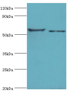 CNDP1 Antibody - Western blot. All lanes: Beta-Ala-His dipeptidase antibody at 4 ug/ml. Lane 1: 293T whole cell lysate. Lane 2: HeLa whole cell lysate. Secondary antibody: Goat polyclonal to rabbit at 1:10000 dilution. Predicted band size: 57 kDa. Observed band size: 57 kDa Immunohistochemistry.
