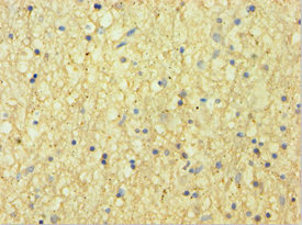 CNDP1 Antibody - Immunohistochemistry of paraffin-embedded human brain tissue using CNDP1 Antibody at dilution of 1:100