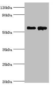 CNDP1 Antibody - Western blot All lanes: Beta-Ala-His dipeptidase antibody at 4µg/ml Lane 1: 293T whole cell lysate Lane 2: Hela whole cell lysate Secondary Goat polyclonal to rabbit IgG at 1/10000 dilution Predicted band size: 57 kDa Observed band size: 57 kDa