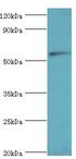 CNDP1 Antibody - Western blot. All lanes: Beta-Ala-His dipeptidase antibody at 2 ug/ml+293T whole cell lysate. Secondary antibody: Goat polyclonal to rabbit at 1:10000 dilution. Predicted band size: 57 kDa. Observed band size: 57 kDa.