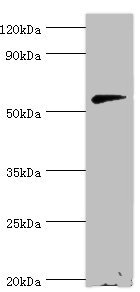 CNDP1 Antibody - Western blot All lanes: Beta-Ala-His dipeptidase antibody at 2µg/ml + 293T whole cell lysate Secondary Goat polyclonal to rabbit IgG at 1/10000 dilution Predicted band size: 57 kDa Observed band size: 57 kDa
