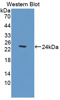 CNDP1 Antibody - Western blot of CNDP1 antibody.