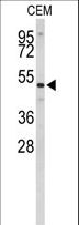CNDP1 Antibody - Western blot of CNDP1 Antibody in CEM cell line lysates (35 ug/lane). CNDP1 (arrow) was detected using the purified antibody.
