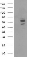 CNDP1 Antibody - HEK293T cells were transfected with the pCMV6-ENTRY control (Left lane) or pCMV6-ENTRY CNDP1 (Right lane) cDNA for 48 hrs and lysed. Equivalent amounts of cell lysates (5 ug per lane) were separated by SDS-PAGE and immunoblotted with anti-CNDP1.