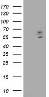 CNDP1 Antibody - HEK293T cells were transfected with the pCMV6-ENTRY control (Left lane) or pCMV6-ENTRY CNDP1 (Right lane) cDNA for 48 hrs and lysed. Equivalent amounts of cell lysates (5 ug per lane) were separated by SDS-PAGE and immunoblotted with anti-CNDP1.