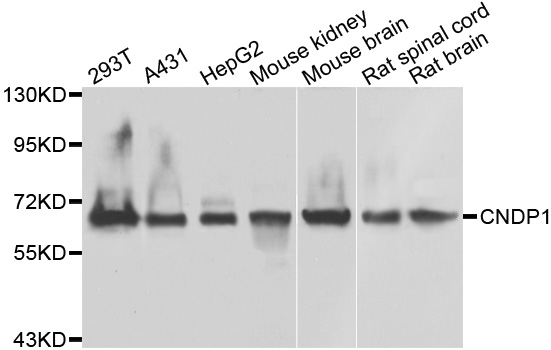CNDP1 Antibody - Western blot analysis of extracts of various cell lines.