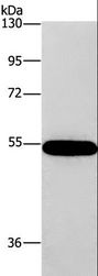 CNDP1 Antibody - Western blot analysis of 293T cell, using CNDP1 Polyclonal Antibody at dilution of 1:320.