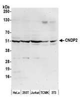 CNDP2 Antibody - Detection of human and mouse CNDP2 by western blot. Samples: Whole cell lysate (50 µg) from HeLa, HEK293T, Jurkat, mouse TCMK-1, and mouse NIH 3T3 cells prepared using NETN lysis buffer. Antibody: Affinity purified rabbit anti-CNDP2 antibody used for WB at 0.4 µg/ml. Detection: Chemiluminescence with an exposure time of 30 seconds.
